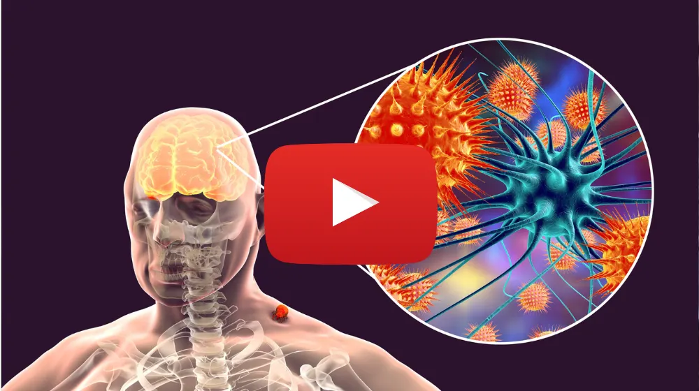 Breaking: Tinnitus Wipes 1% Of Your Memories Every Month
